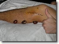 zátiší s jizvou a kaštany